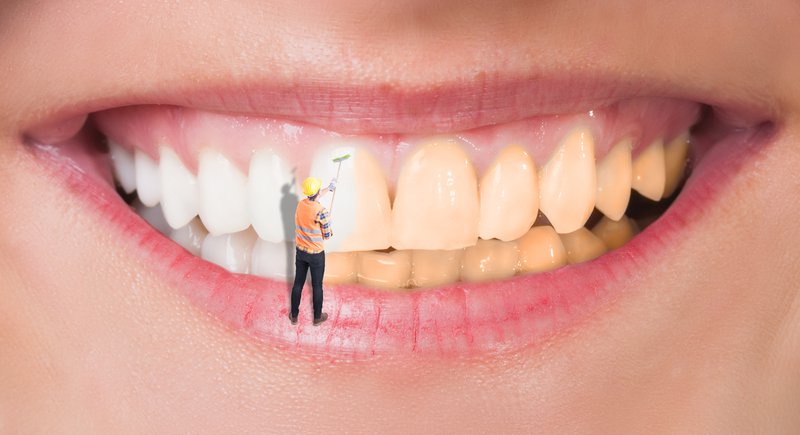 dental cleaning